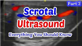 Scrotal Ultrasound Everything You Should Know (part 2)