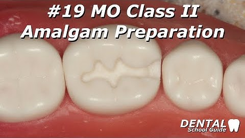 Class II Amalgam Preparation || #19 MO