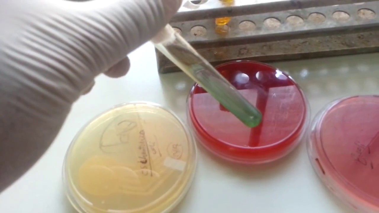 Corynebacterium spp kenet férfiakban, Streptococcus férfiaknál - Hörghurut