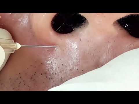 Relaxing Medical and Derm Video! Best Educational Health
