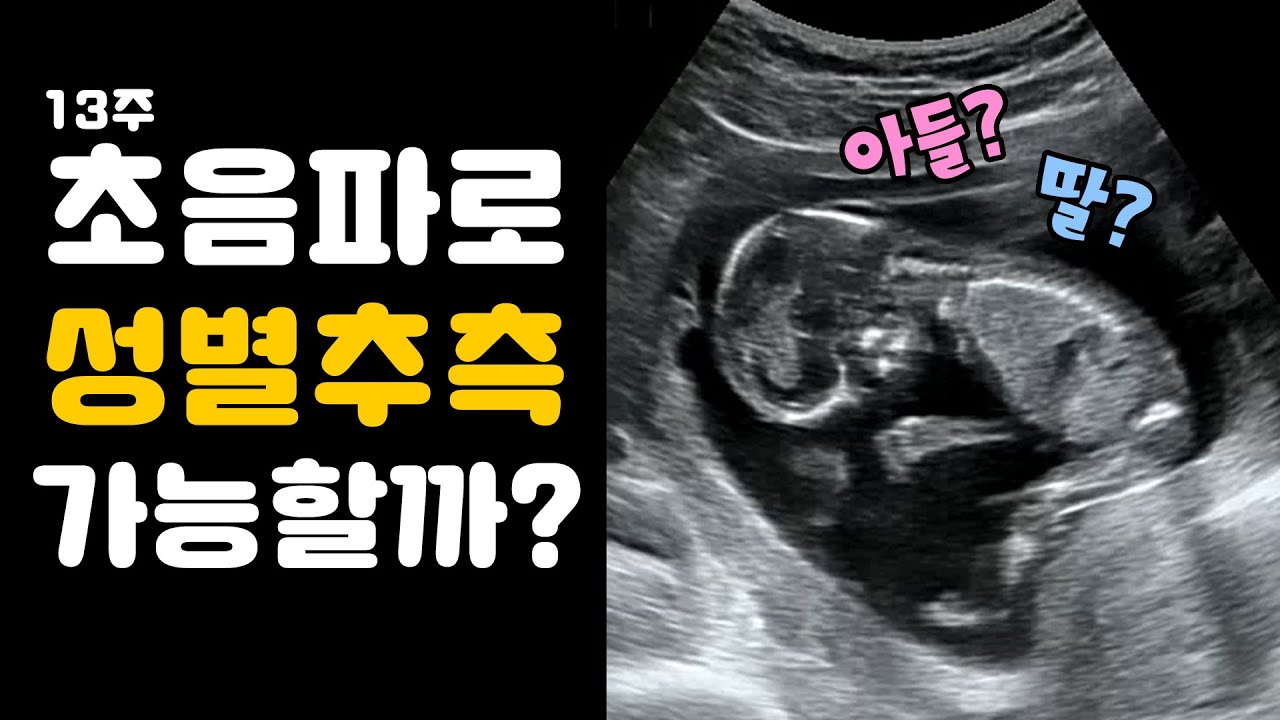 임신 후 가장 궁금한 아기의 성별👶🏻 초음파 보며 같이 맞춰볼까요?