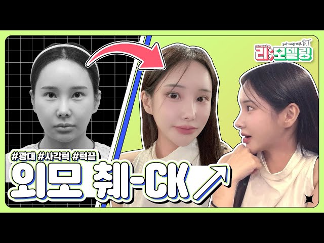 [비티성형외과 리얼스토리] 윤곽3종 후기 VLOG