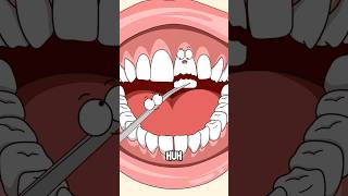 How did the dentist reattach the broken tooth?#shorts #funny #hot