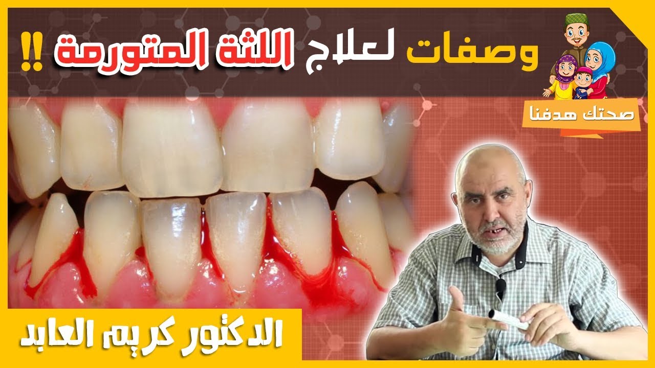 علاج اللثة الملتهبة اوالمتورمة والمريضة 🦷 بوصفات طبيعية مع الدكتور كريم العابد العلوي