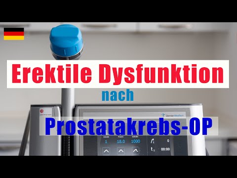 Video: 4 Möglichkeiten, um zu wissen, ob Sie Prostatakrebs haben