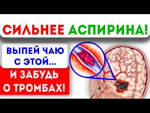 РАЗЖИЖАЕТ ЛУЧШЕ АСПИРИНА! Этот... позволит навсегда забыть о тромбах и густой крови!