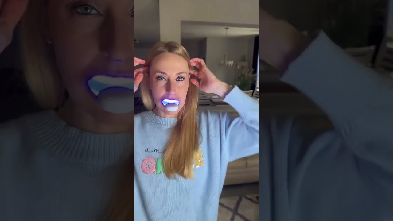 Tiktok Teeth Whitening Trends – Do They Work