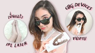 รีวิวเครื่องกำจัดขน IPL Laser เห็นผลไว (CBG Devices) | Anna cares skin