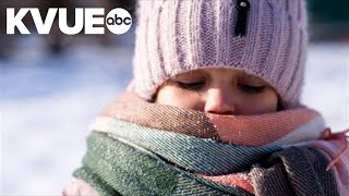 What are the signs and symptoms of hypothermia?