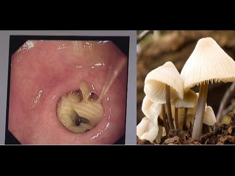 Video: Apakah Mungkin Makan Jamur Mentah Dari Toko