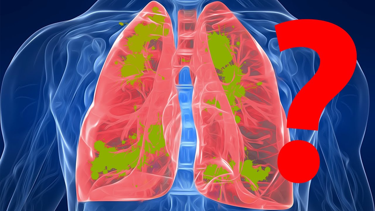 Fibrosi cistica solo i polmoni o c'è altro? Spiegazione YouTube