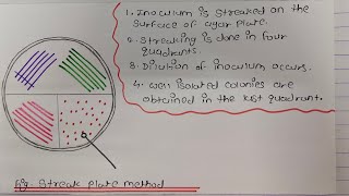 Media for microbial culture 🧫 &amp; Inoculation method | IMPquestion| Zoology and Microbiology students🥳