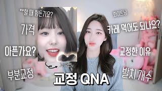 드디어 교정기 뻈습니다!🦷성형한거아님|교정 QNA|아프나요?|얼굴변화|발치|총비용|병원고르는팁