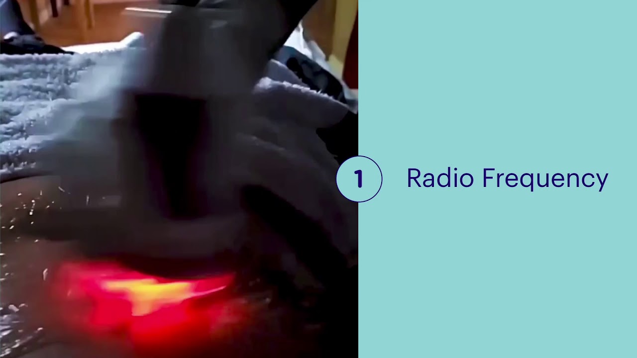 Skin Tightening Stomach- Radio Frequency - YouTube