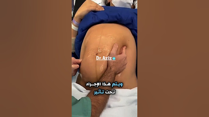 تعديل الوضع المقعدي للجنين