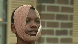 Boy recovering from dog attack in Spring