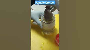 Female reproductive system  Female Uterus #trending #reproduction #anatomy #lab #trending #mbbs