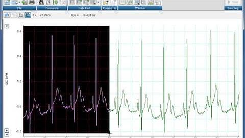 Using the Zoom window in ADInstruments LabChart