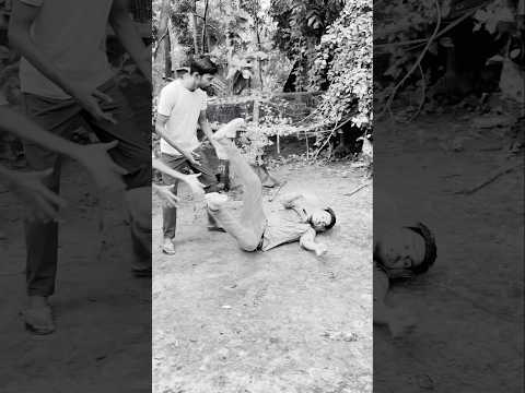 সাপের কামড় 😐