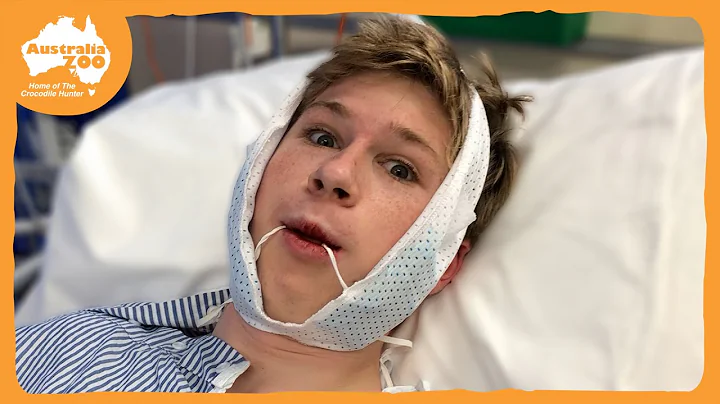 Robert Irwin's wisdom teeth adventure | Irwin Fami...