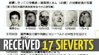 The most terrible victim of radiation in the world - Hisashi Ouchi
