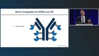 Download Lagu A New View of the Spectrum of HER2 Expression and Significance of HER2 Low in Breast Cancer MP3