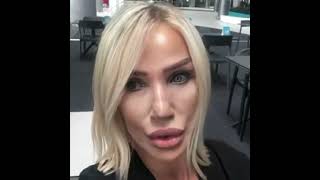 Seda Sayanın Demet Akalına Cevaben Çektiği Videoda Yüzündeki Değişiklik Dikkat Çekti.