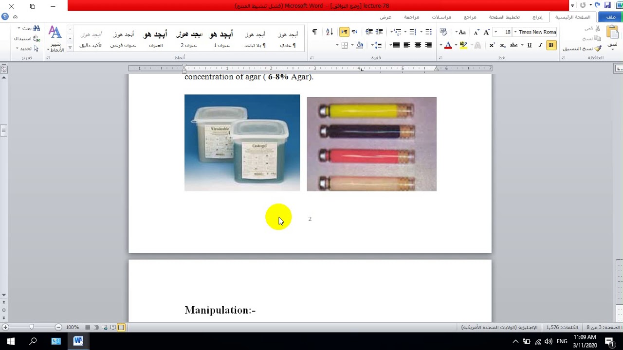Elastic Impression Materials Hydrocolloid part 1 YouTube
