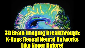 3D Brain Imaging Breakthrough: X-Rays Reveal Neural Networks Like Never Before!