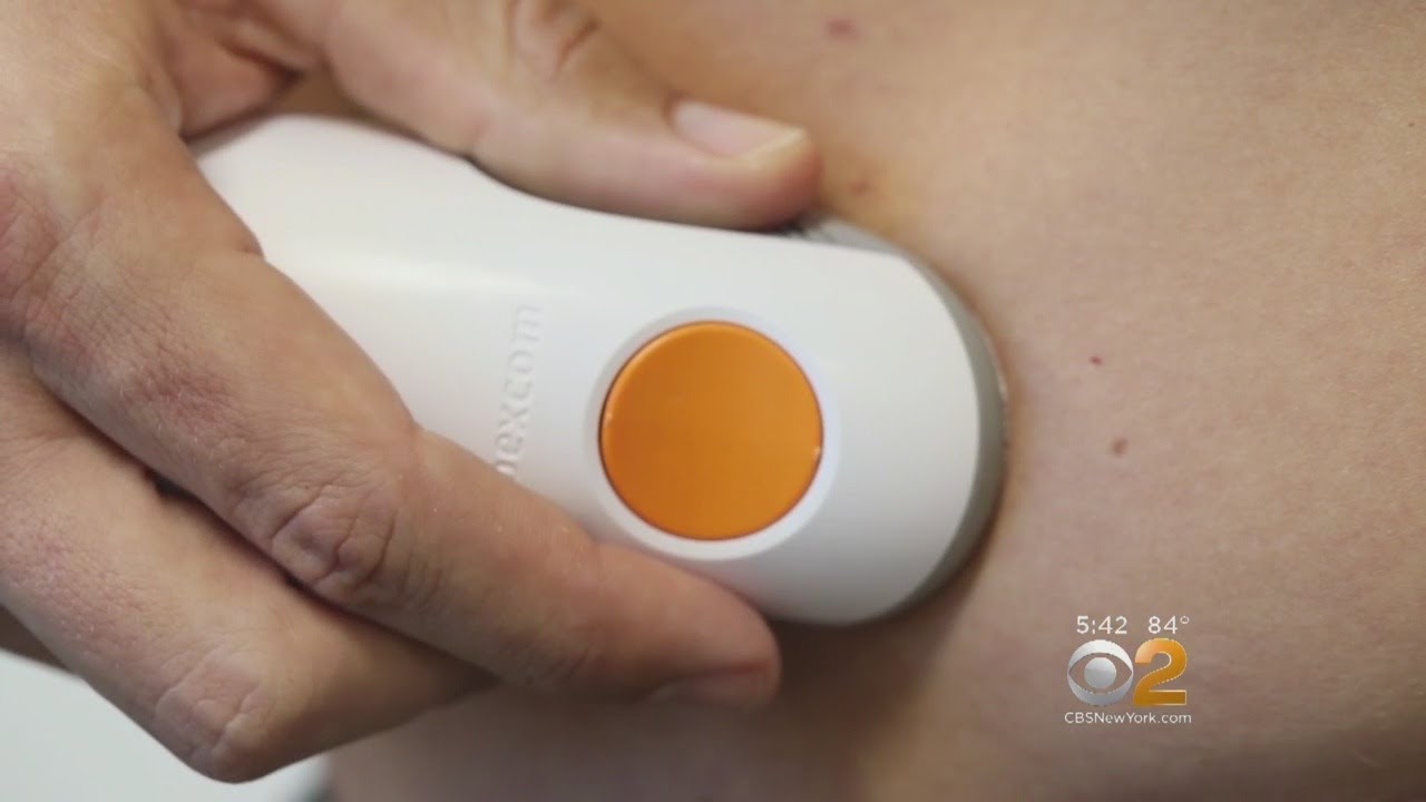 New Device Monitors Blood Sugar Levels