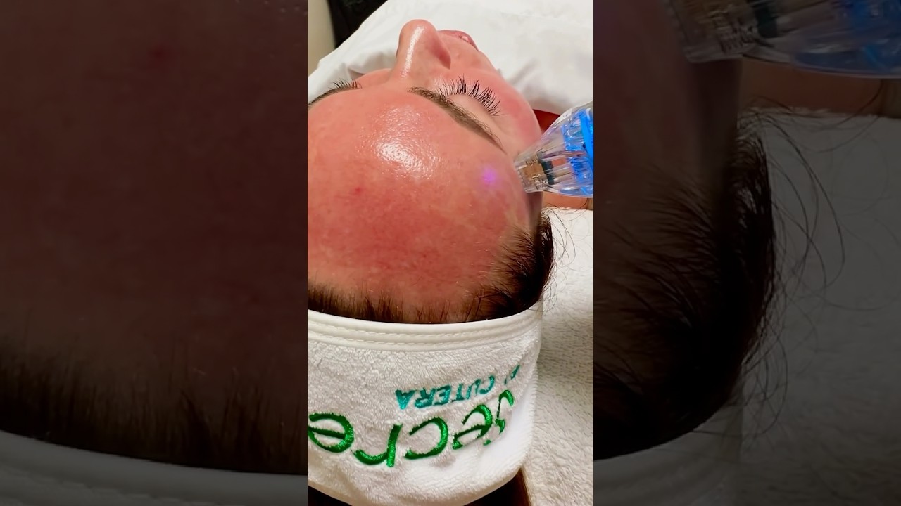 Secret Pro for the Total Skin Rejuvenation 