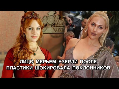 ЛИЦО МЕРЬЕМ УЗЕРЛИ ПОСЛЕ ПЛАСТИКИ ШОКИРОВАЛО ПОКЛОННИКОВ. Meryem Uzerli. Турецкие актёры .