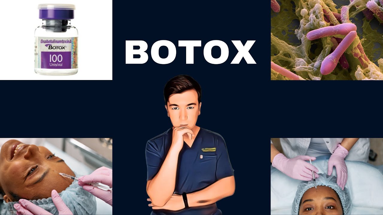BOTOX (Botoks) va uning organizmga ta'siri