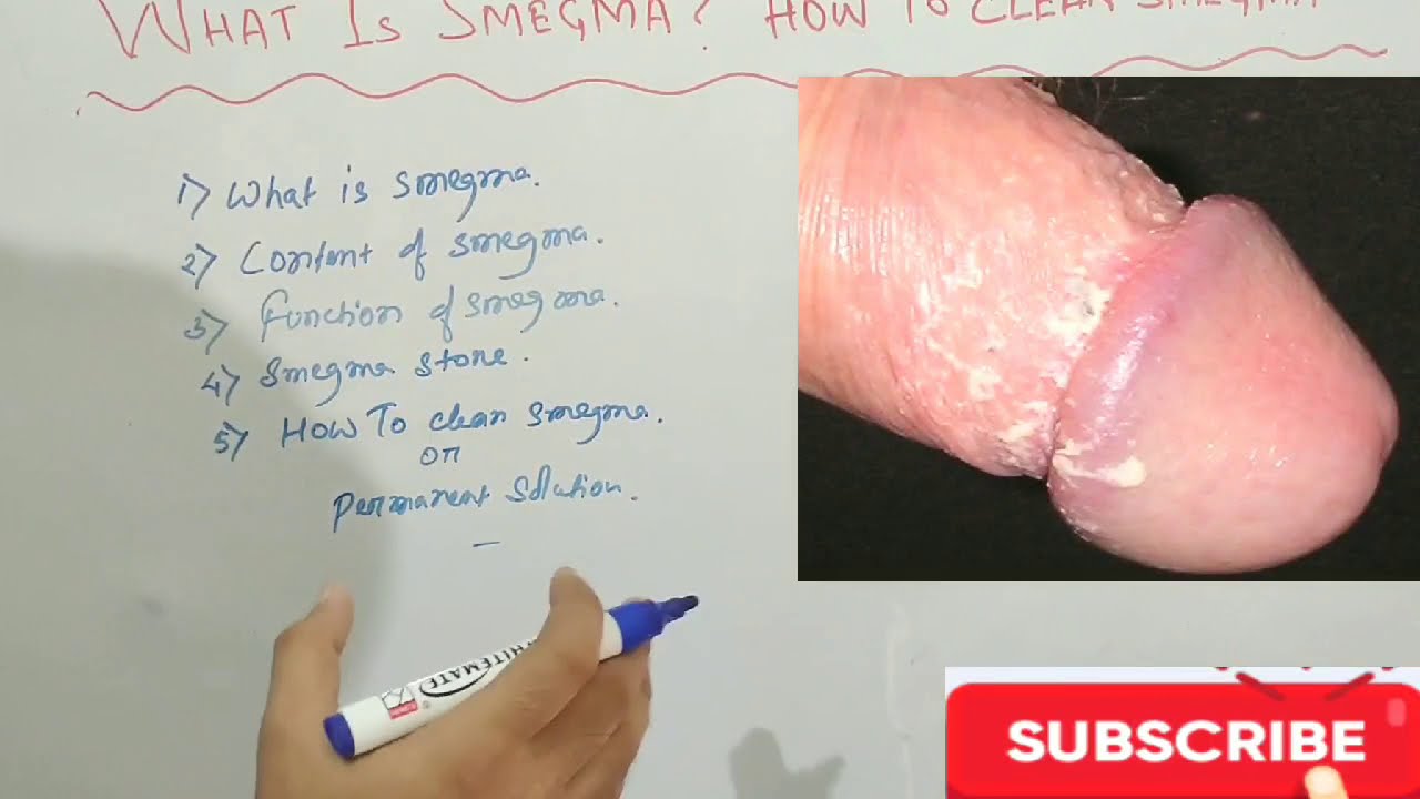 smegma, white material under penis skin, is it normal to have Smegma every ...