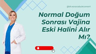 Normal Doğumdan Sonra Vajina Eski Halini Alır Mı