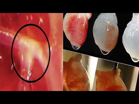 Clean Your Arteries and Prevent Heart Attack / Top 10 super Foods Clean Your Arteries and Prevent