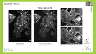 An open source structured illumination microscopy extension for general fluorescence microscope body