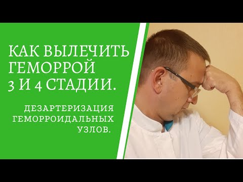 КАК ВЫЛЕЧИТЬ ГЕМОРРОЙ 3 И 4 СТАДИИ? / Дезартеризация геморроидальных узлов.