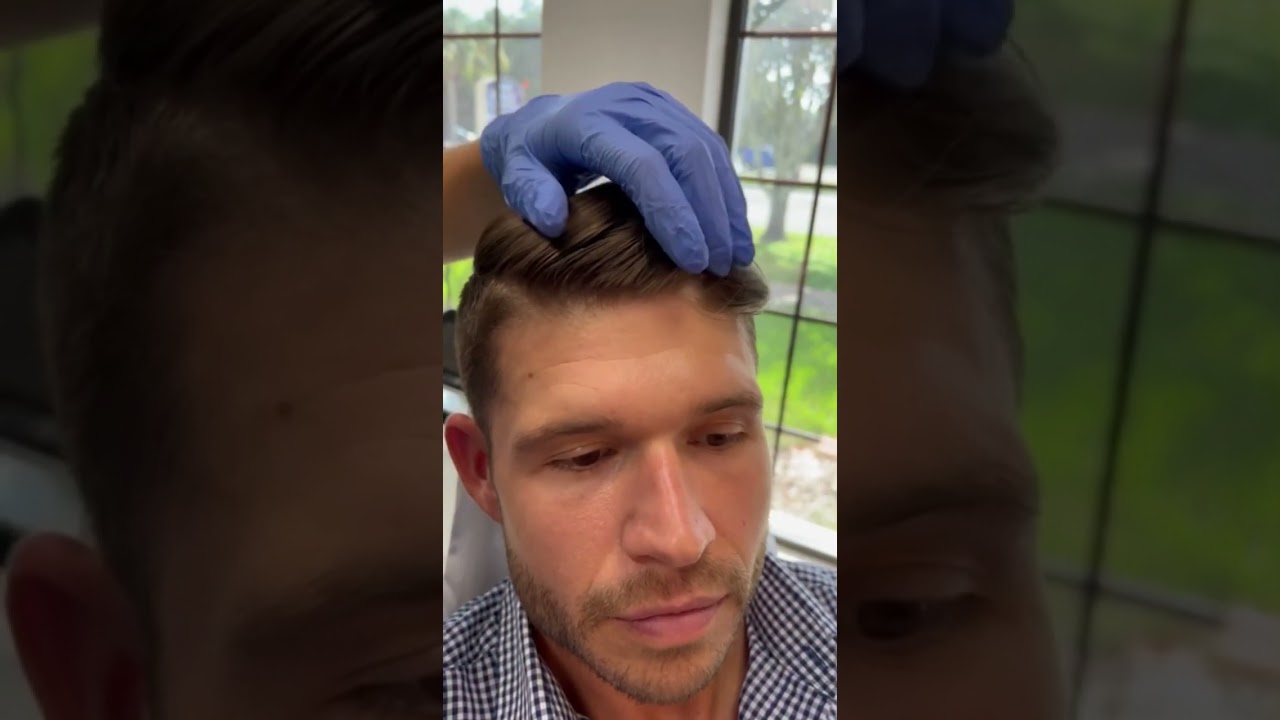Baby Botox for Men - quick antiaging treatments for men - medspa plastic surgery Tampa Fl