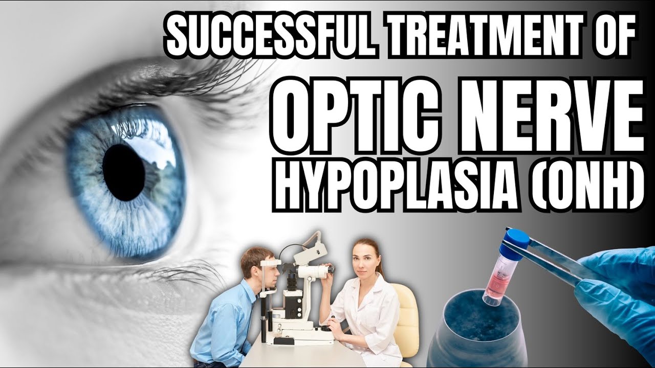 Stem cell Treatment Breakthrough for Optic nerve Hypoplasia (ONH) - YouTube