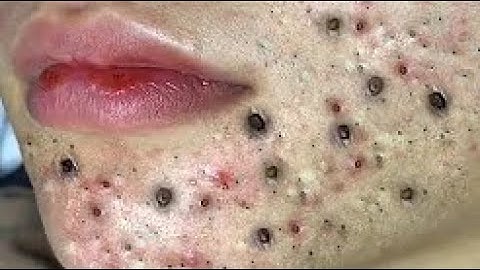 When you reach the end of your rope, tie a knot in it and hang on #215