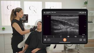 [Español] Ultrasound of the Muscles in the Lower Third of the Face