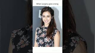 Celebrity When surgery goes wrong #dishapatani #bollywood #shortfeeds #music #shorts Profile