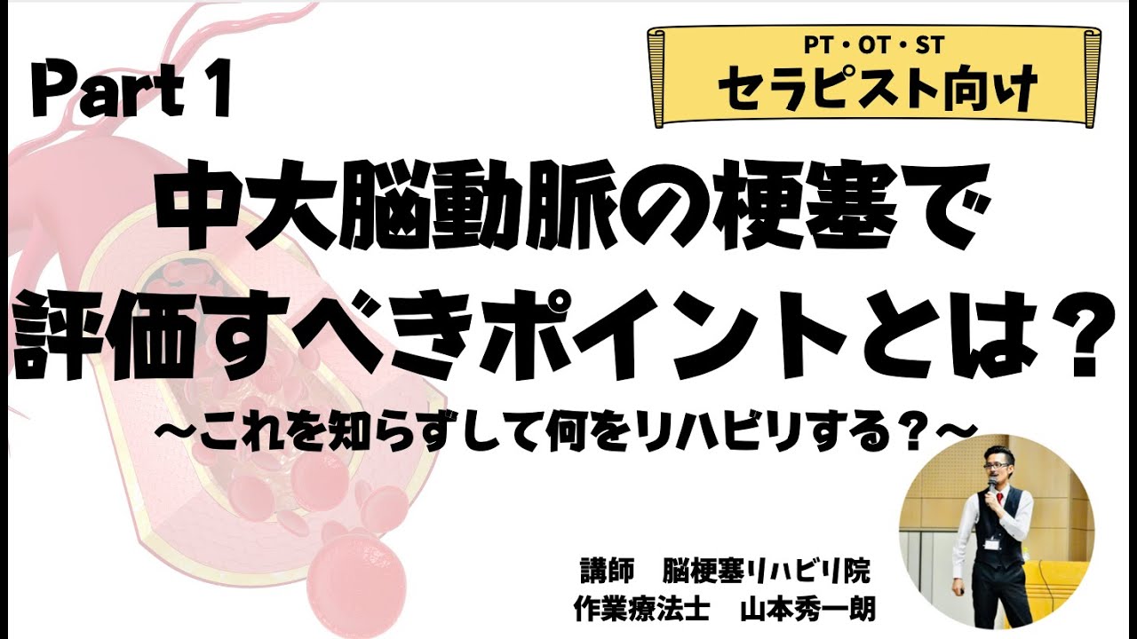 【脳梗塞　リハビリ　セラピスト向け】中大脳動脈の脳梗塞の評価のポイントとは？