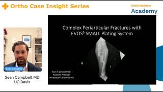 Ortho Case Insight Series |Complex Periarticular Fracture Management with EVOS◊ SMALL Plating System