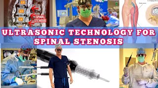 𝐔𝐥𝐭𝐫𝐚𝐬𝐨𝐧𝐢𝐜 Spine Surgery 𝐓𝐞𝐜𝐡𝐧𝐨𝐥𝐨𝐠𝐲 for Spinal Stenosis! 😀🧐🥳