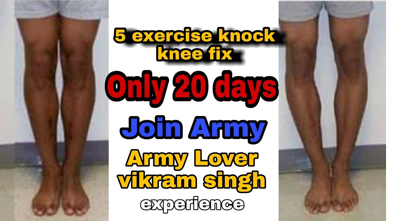 Knock knee problem fix / how to fix knock knee problem / knock knee ko kaise thik kare / army