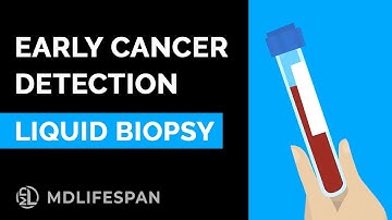 Early Cancer Detection Blood Test - Liquid Biopsy