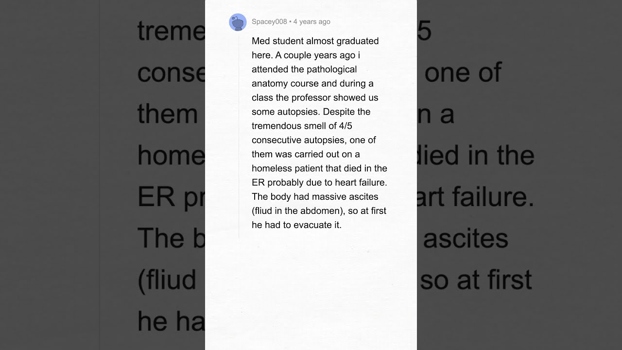 Shocking Autopsy Secrets Reddit S Biggest Death Revelations 