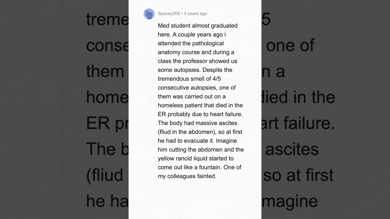 Shocking Autopsy Secrets: Reddit’s Biggest Death Revelations!